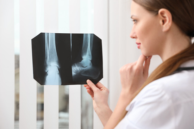 Orthopedist examining X-ray picture near window in office, focus on hand
