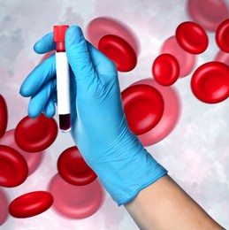 Image of Scientist in gloves holding test tube with blood sample and illustration of erythrocytes on light background, closeup