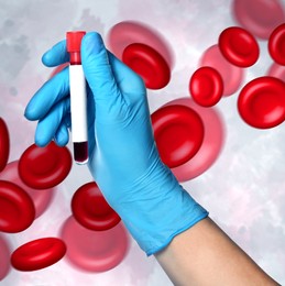 Scientist in gloves holding test tube with blood sample and illustration of erythrocytes on light background, closeup