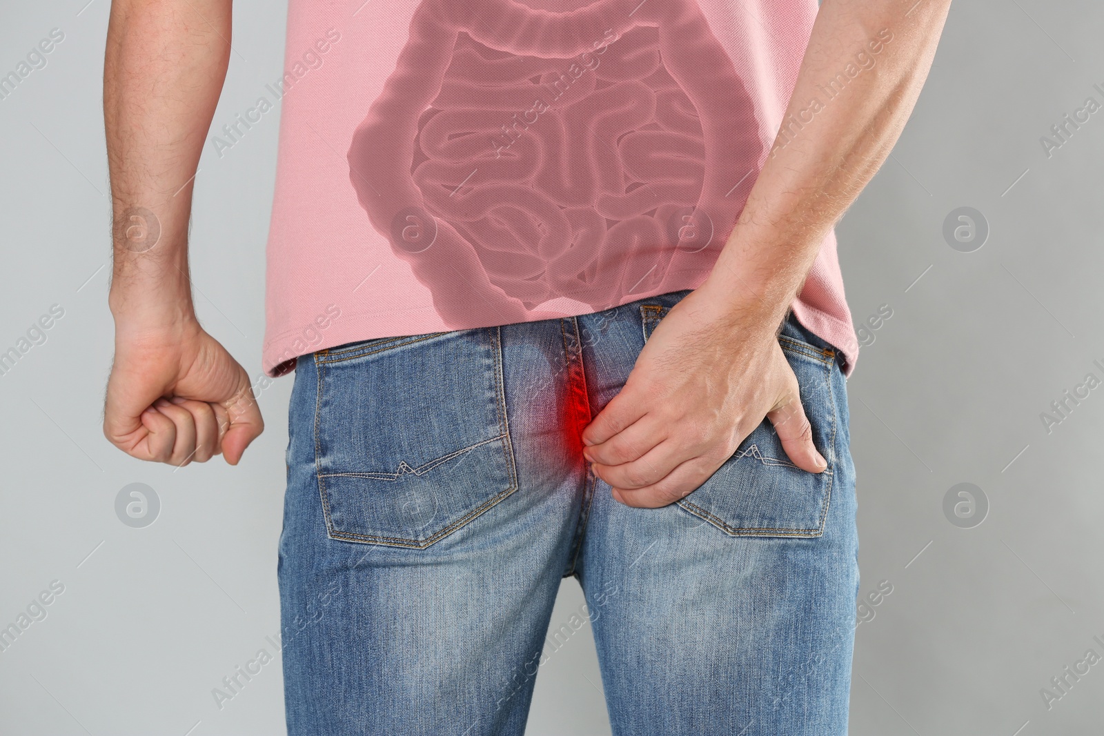 Image of Man suffering from hemorrhoid on light grey background, closeup. Unhealthy bowel illustration