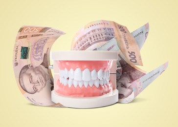 Image of Model of oral cavity with teeth and hryvnia banknotes on beige background. Concept of expensive dental procedures