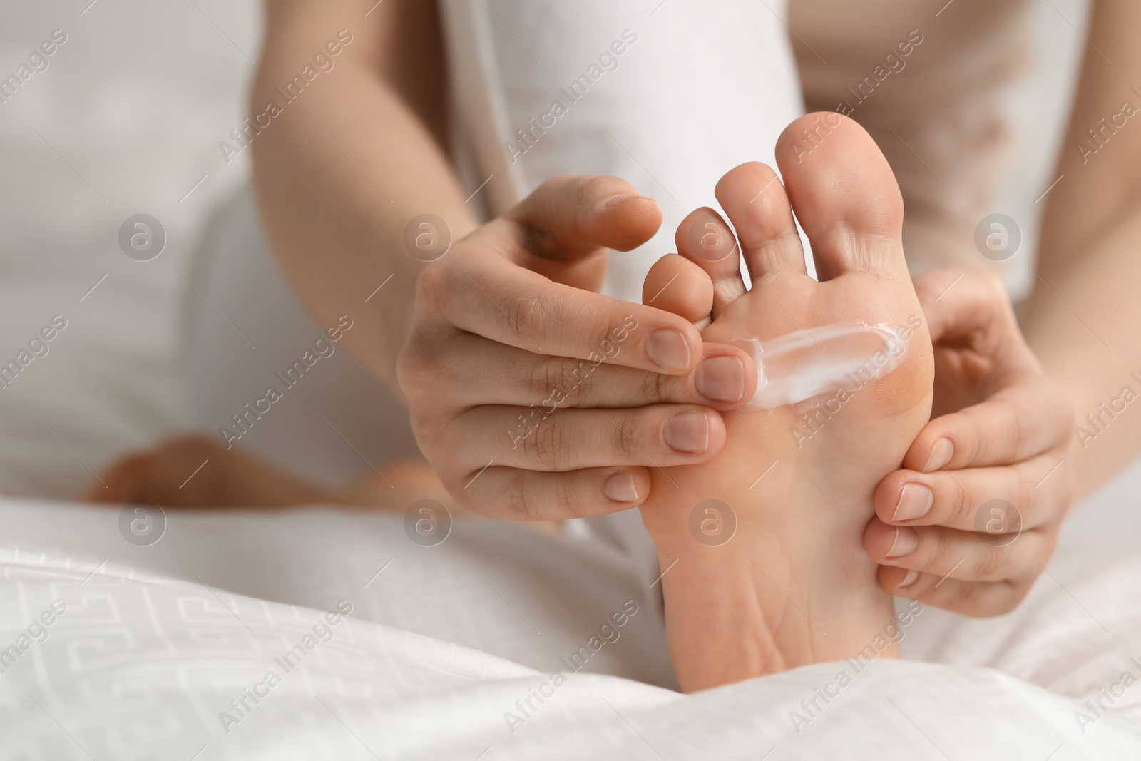 Photo of Young woman with dry skin applying cream onto her foot on bed, closeup