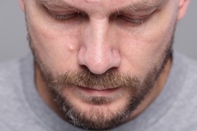 Photo of Closeup view of man with normal skin on grey background