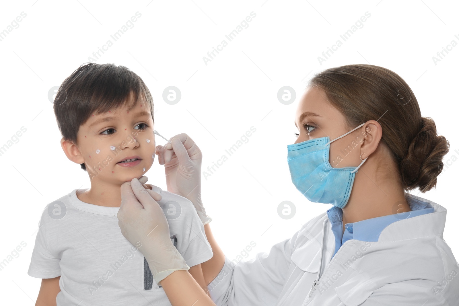 Photo of Doctor applying cream onto skin of little boy with chickenpox against white background. Varicella zoster virus