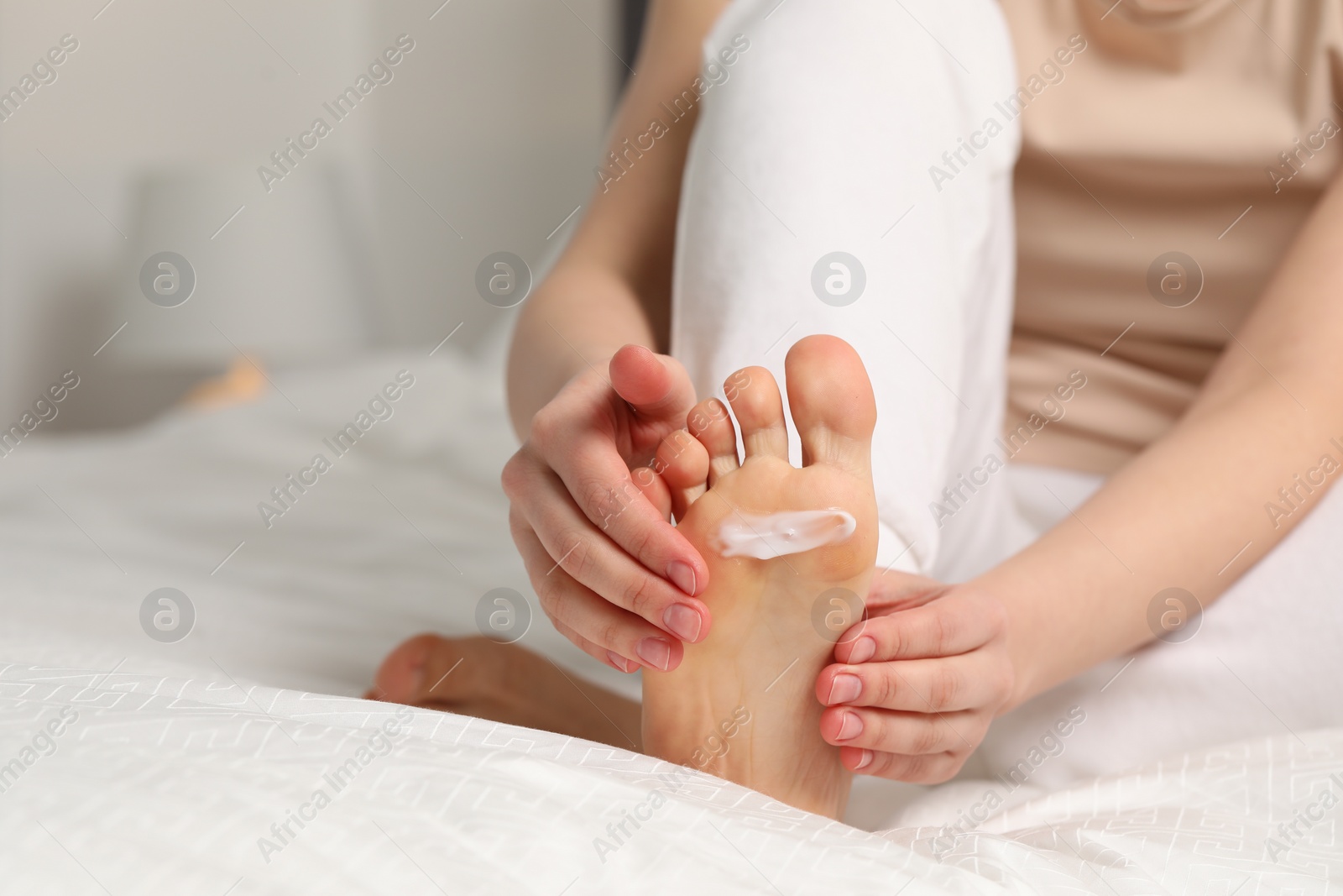 Photo of Young woman with dry skin applying cream onto her foot indoors, closeup