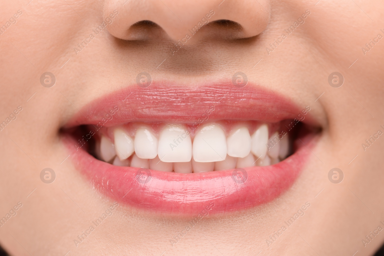 Photo of Woman with clean teeth smiling, closeup view