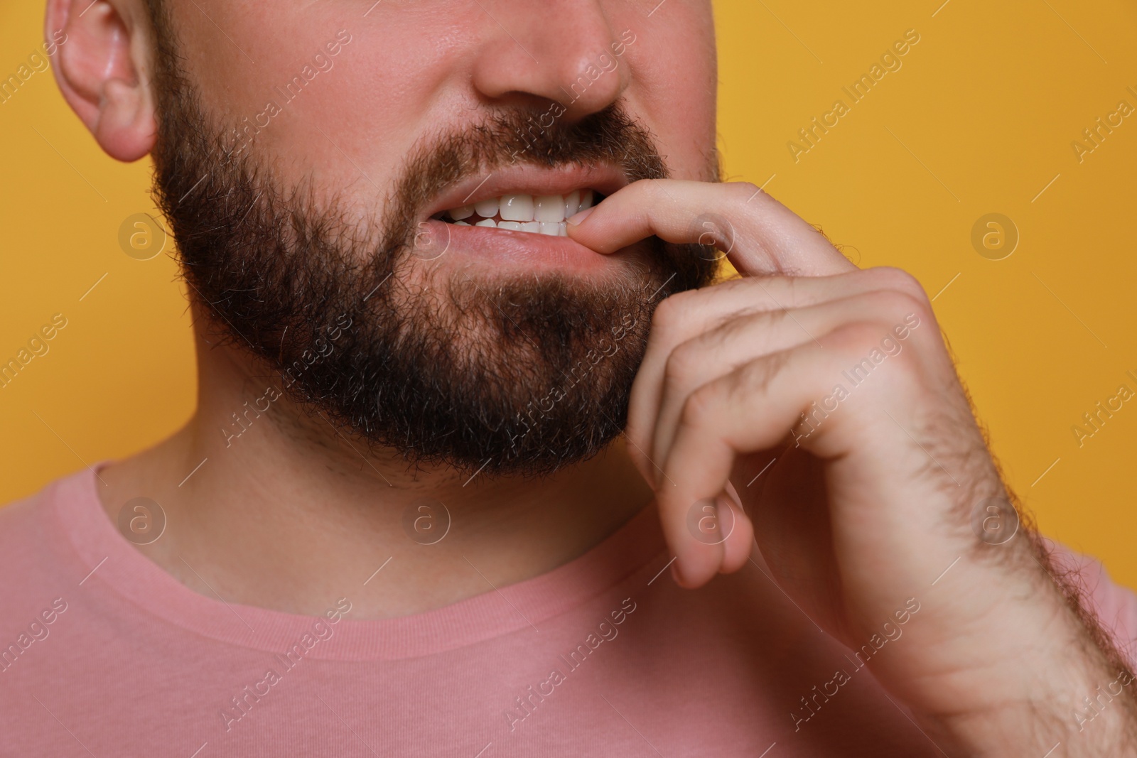 Photo of Man biting his nails on yellow background, closeup. Bad habit