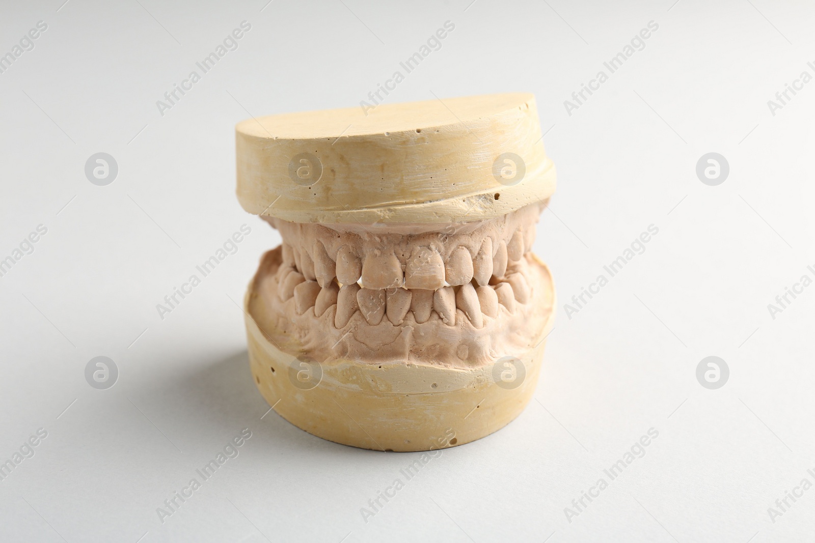 Photo of Dental model with gums on light grey background. Cast of teeth