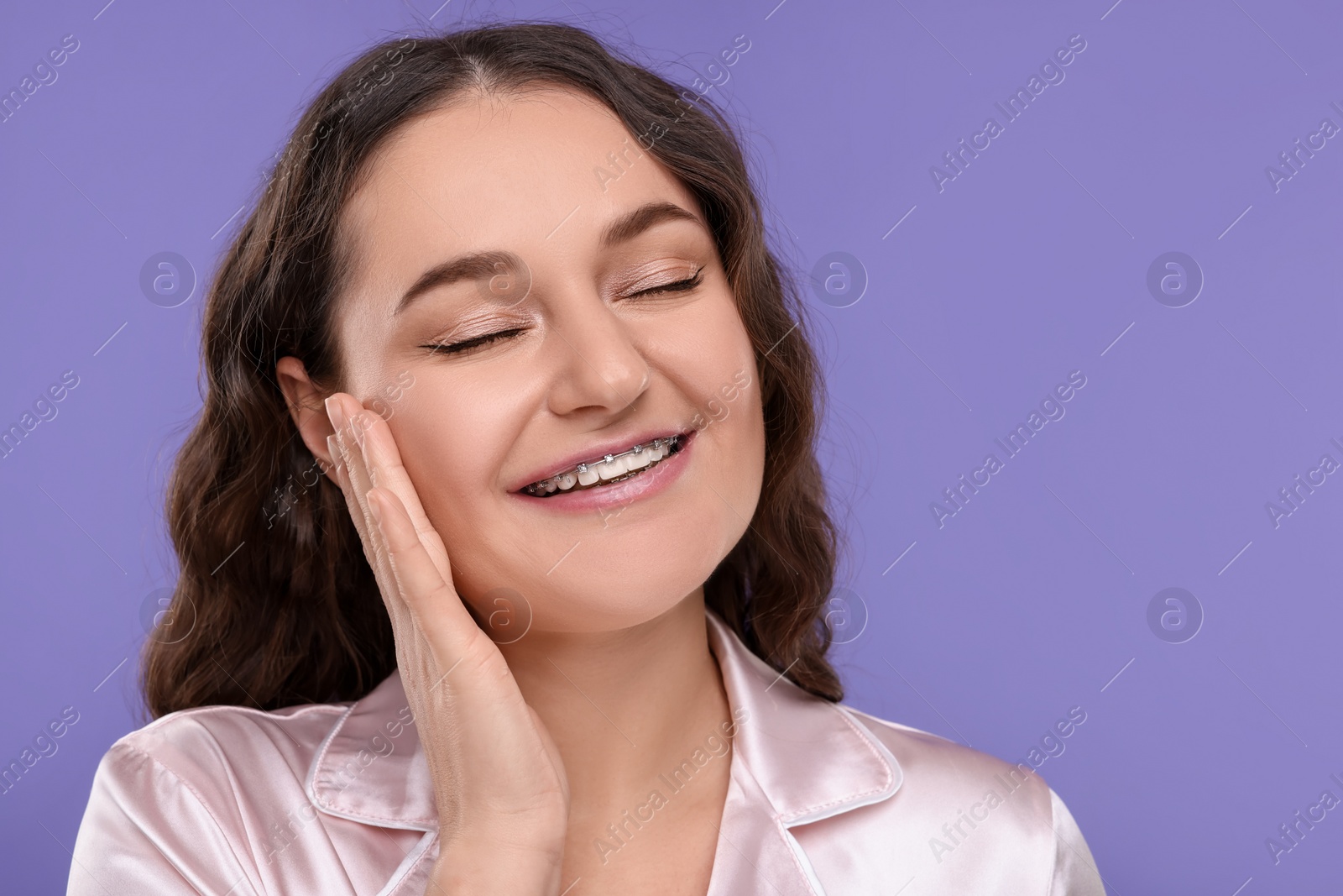 Photo of Smiling woman with dental braces on violet background. Space for text