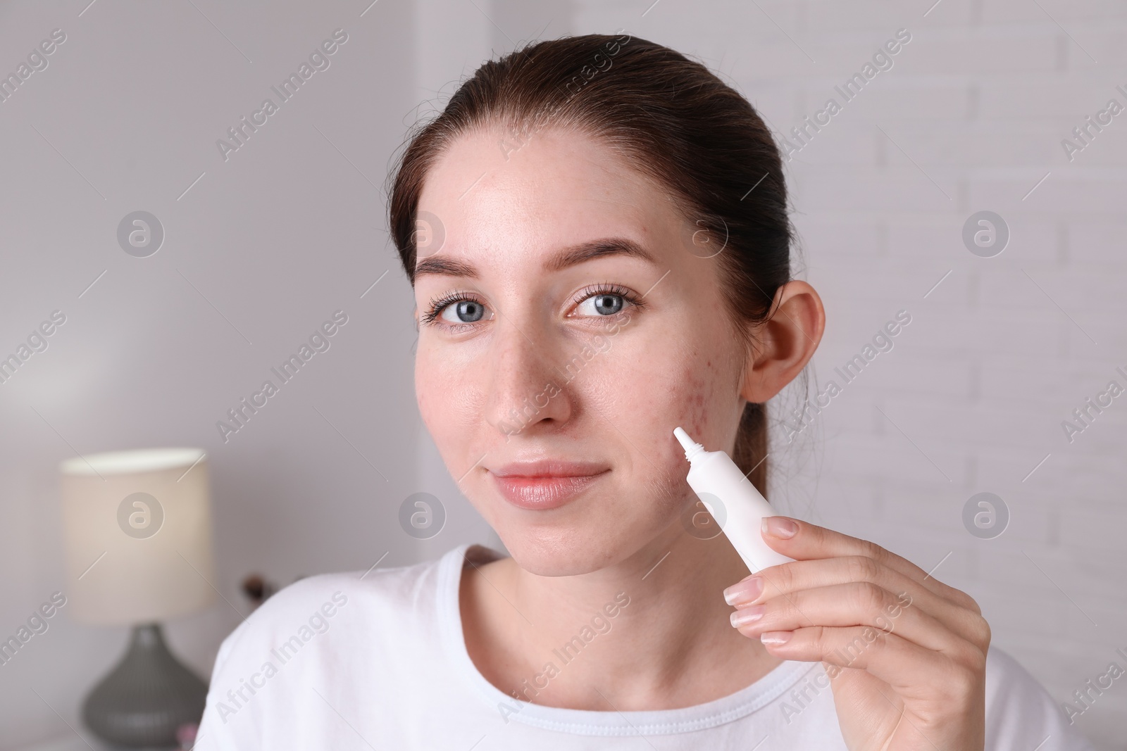 Photo of Woman with acne problem applying cream at home