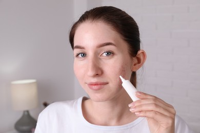 Woman with acne problem applying cream at home