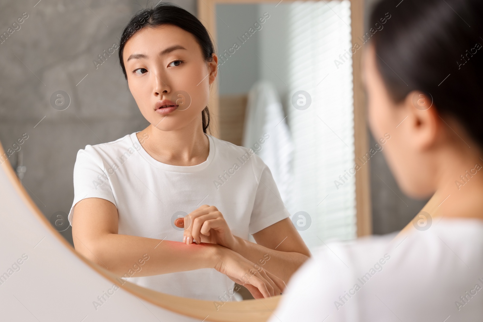 Photo of Suffering from allergy. Young woman scratching her arm near mirror in bathroom