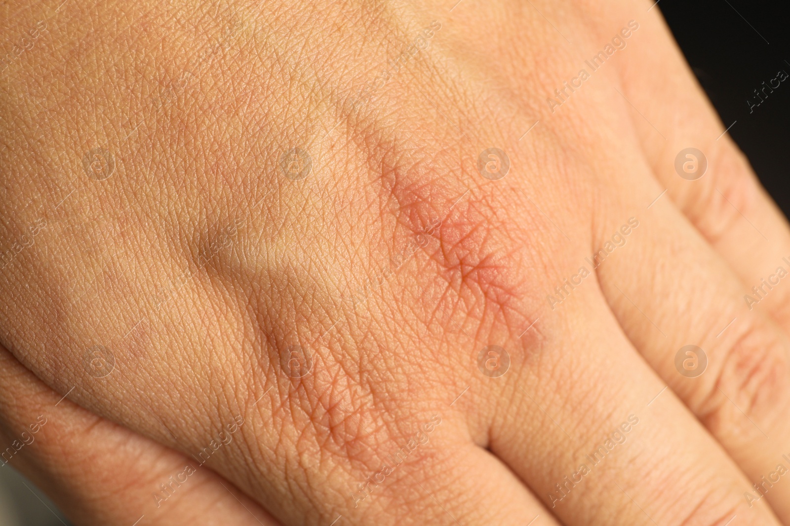 Photo of Top view of person with clean skin on hand, closeup