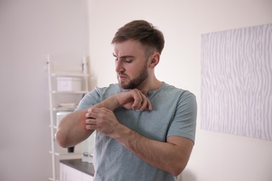 Photo of Young man scratching forearm indoors. Allergy symptoms