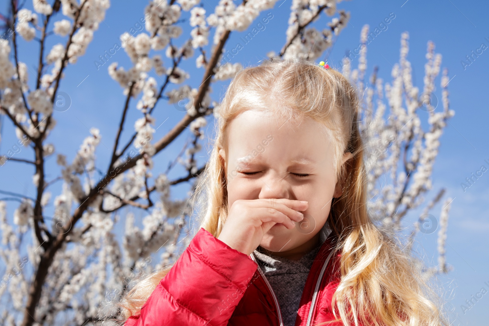 Photo of Little girl suffering from seasonal allergy outdoors