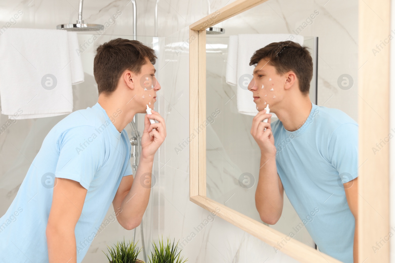 Photo of Teen guy with acne problem applying cream near mirror in bathroom