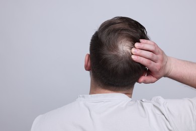 Photo of Baldness concept. Man with bald spot on light grey background, back view. Space for text