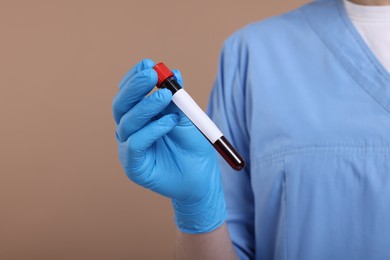 Photo of Laboratory testing. Doctor with blood sample in tube on light brown background, closeup. Space for text