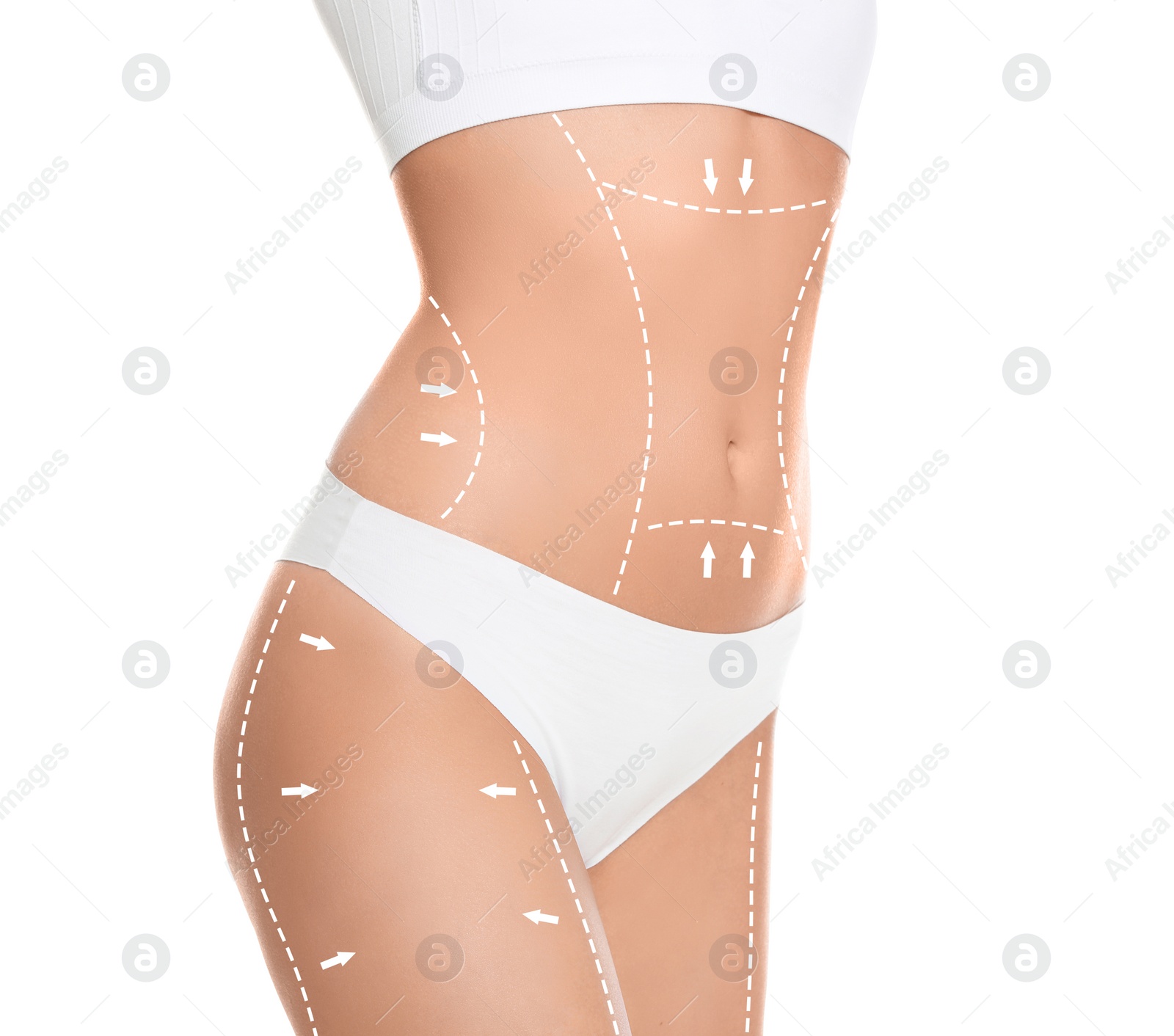 Image of Slim young woman with marks on body for cosmetic surgery operation against white background, closeup