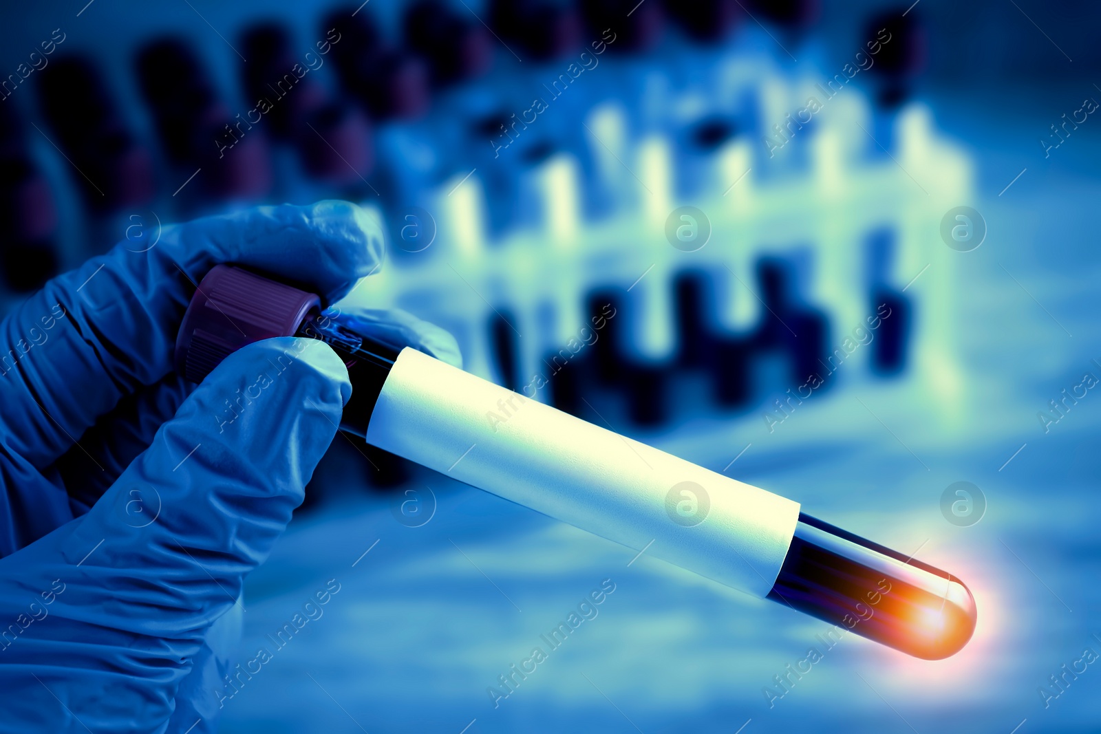 Image of Laboratory worker holding test tube with blood sample over table, closeup. Color toned