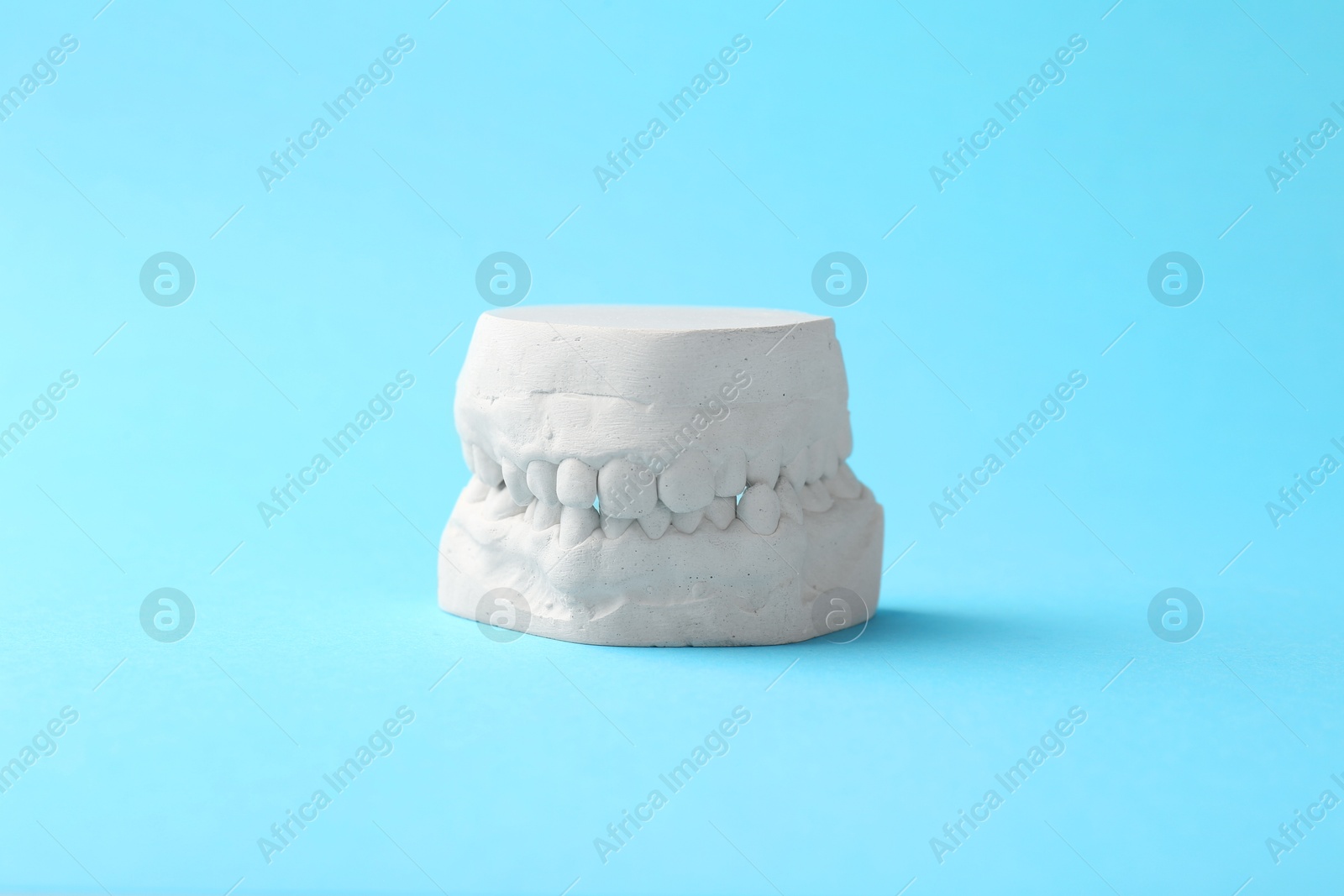 Photo of Dental model with gums on light blue background. Cast of teeth