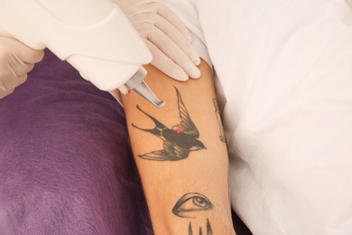 Young man undergoing laser tattoo removal procedure in salon, closeup