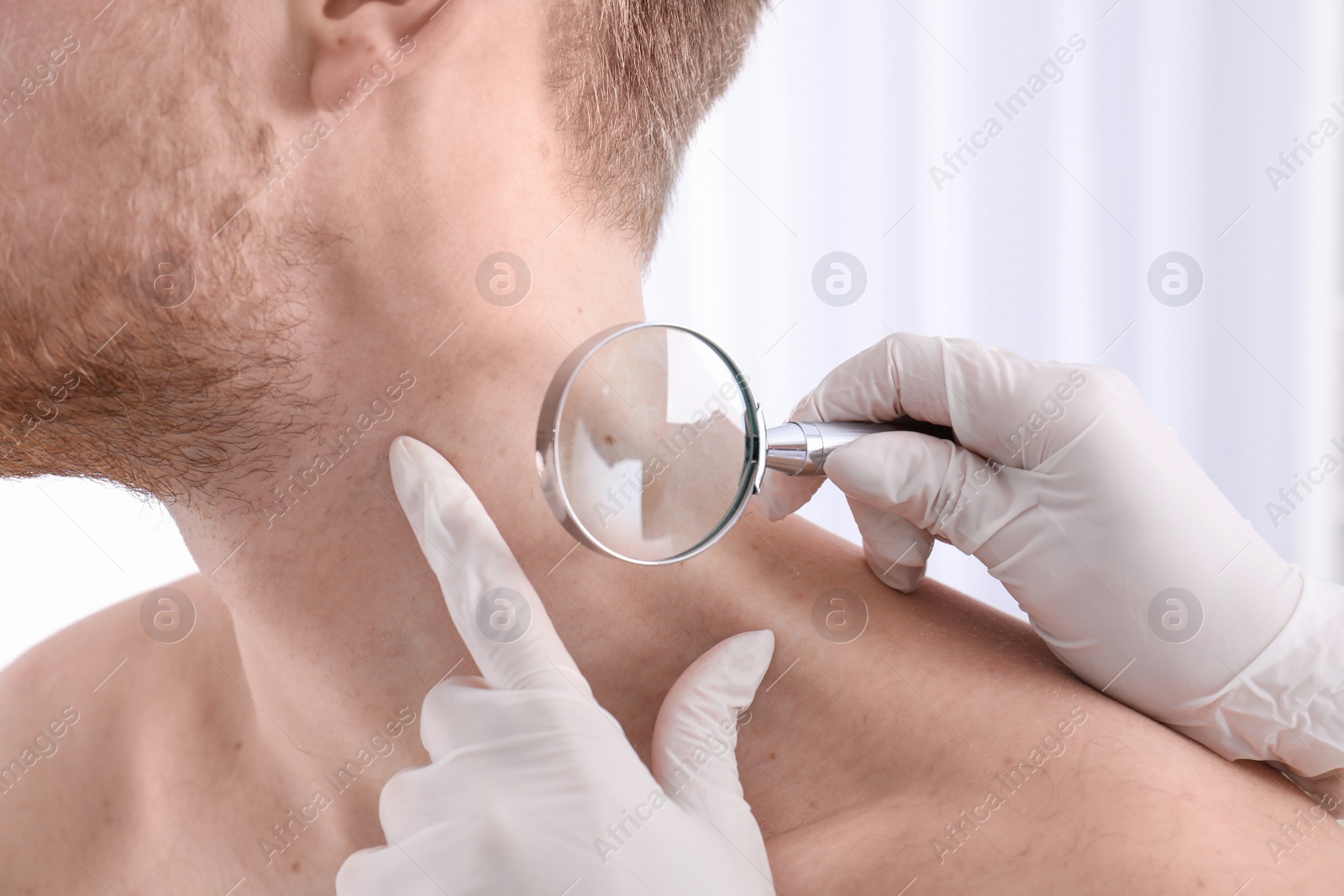 Photo of Dermatologist examining patient with magnifying glass in clinic, closeup view