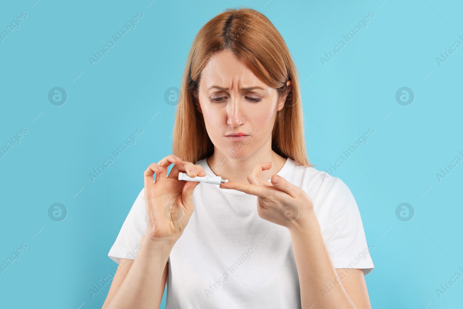 Photo of Upset woman with herpes applying cream on lips against light blue background