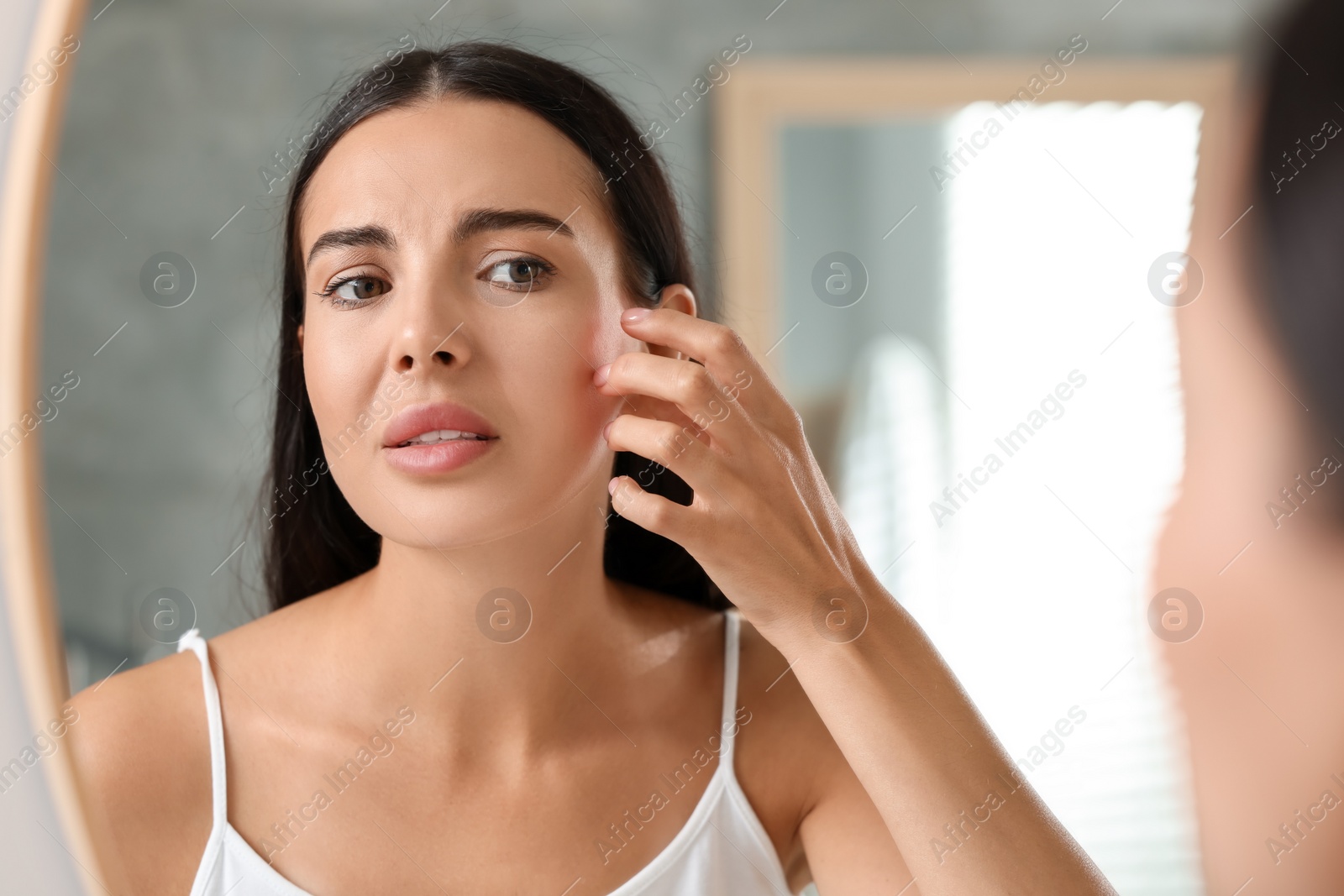 Photo of Suffering from allergy. Young woman scratching her face near mirror indoors