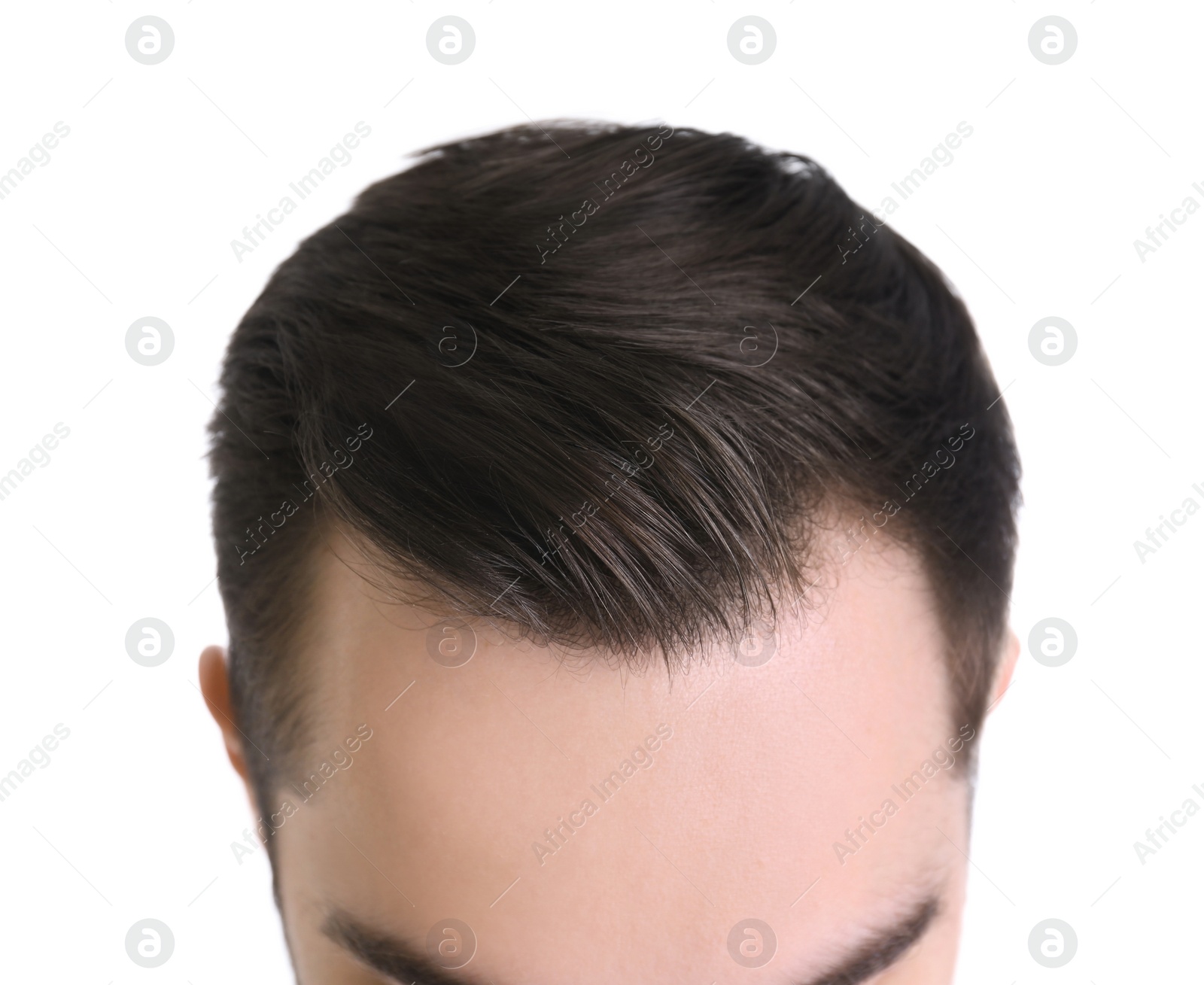 Photo of Young man with hair loss problem on white background, closeup