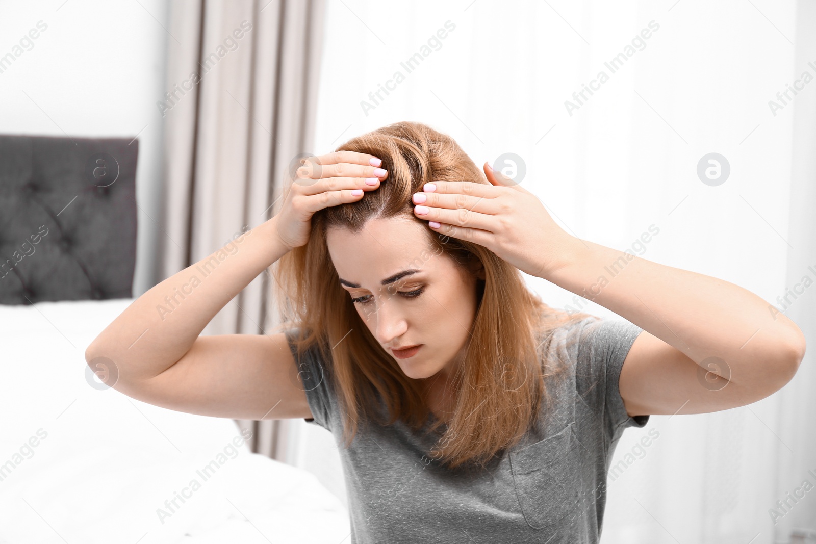 Photo of Young woman with hair loss problem in bedroom