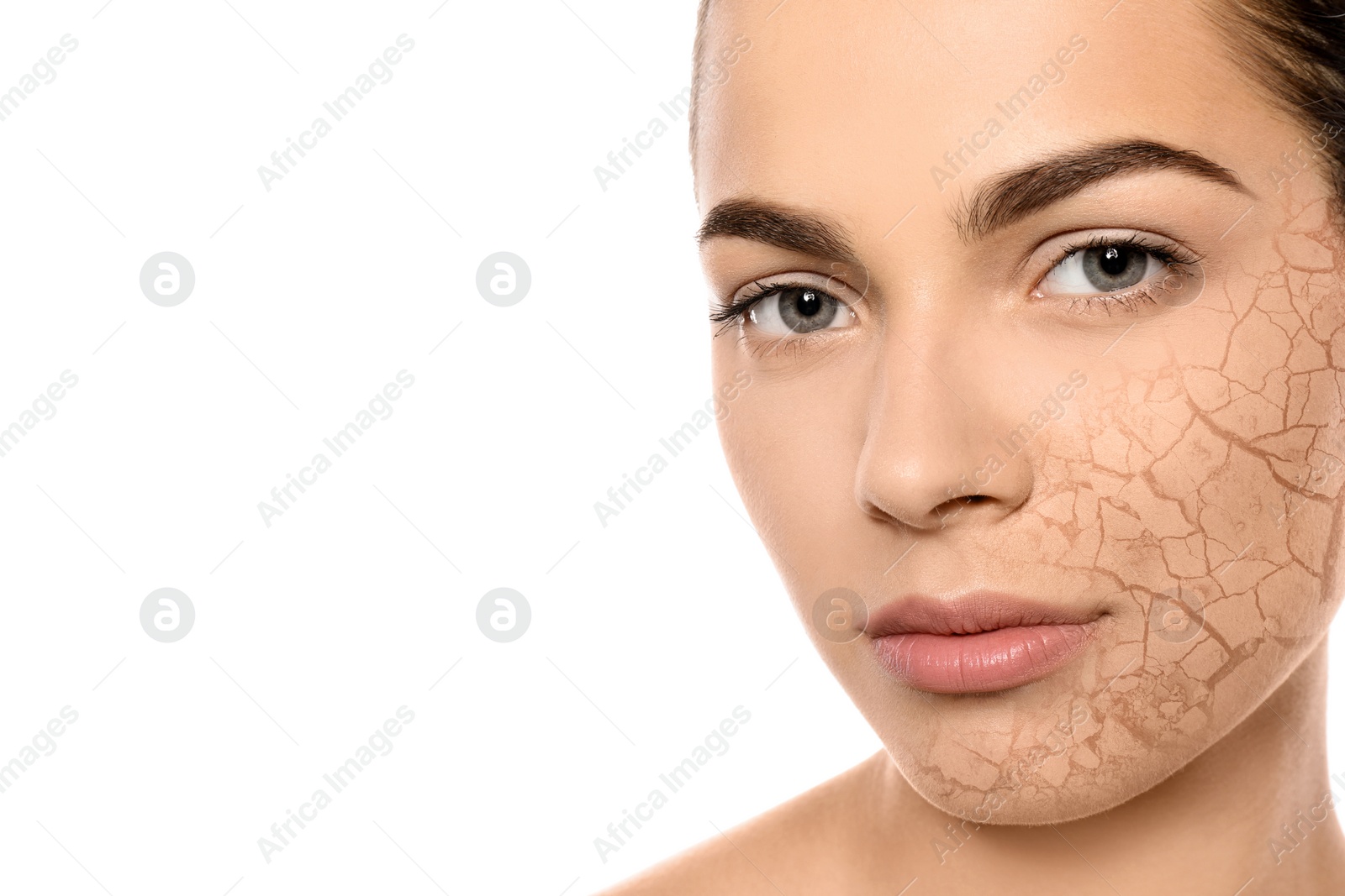 Image of Beautiful young woman with dry skin on white background