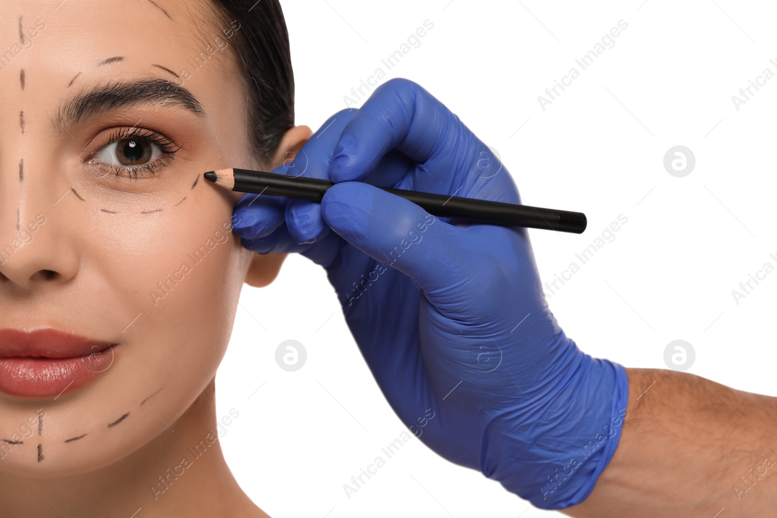 Photo of Doctor with pencil preparing patient for cosmetic surgery operation on white background, closeup