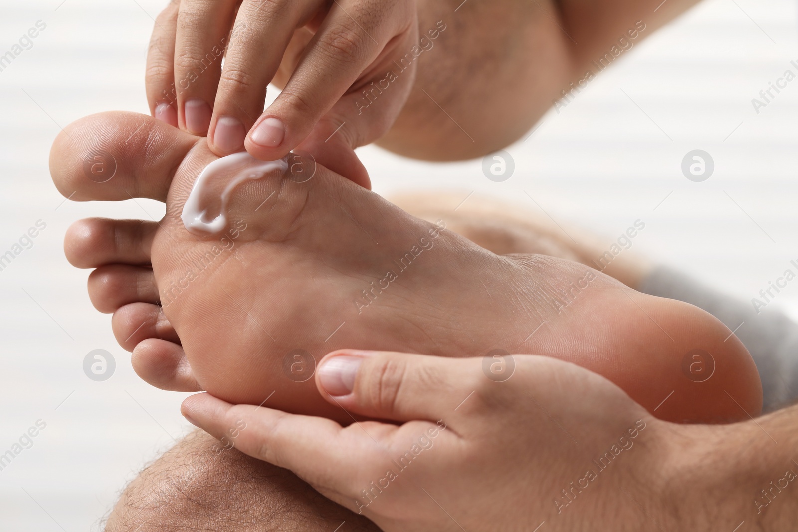 Photo of Man with dry skin applying cream onto his foot on light background, closeup