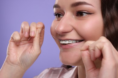 Photo of Woman with braces cleaning teeth using dental floss on violet background, closeup