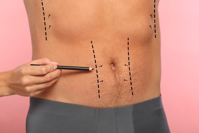 Man preparing for cosmetic surgery, pink background. Doctor drawing markings on his abdomen, closeup