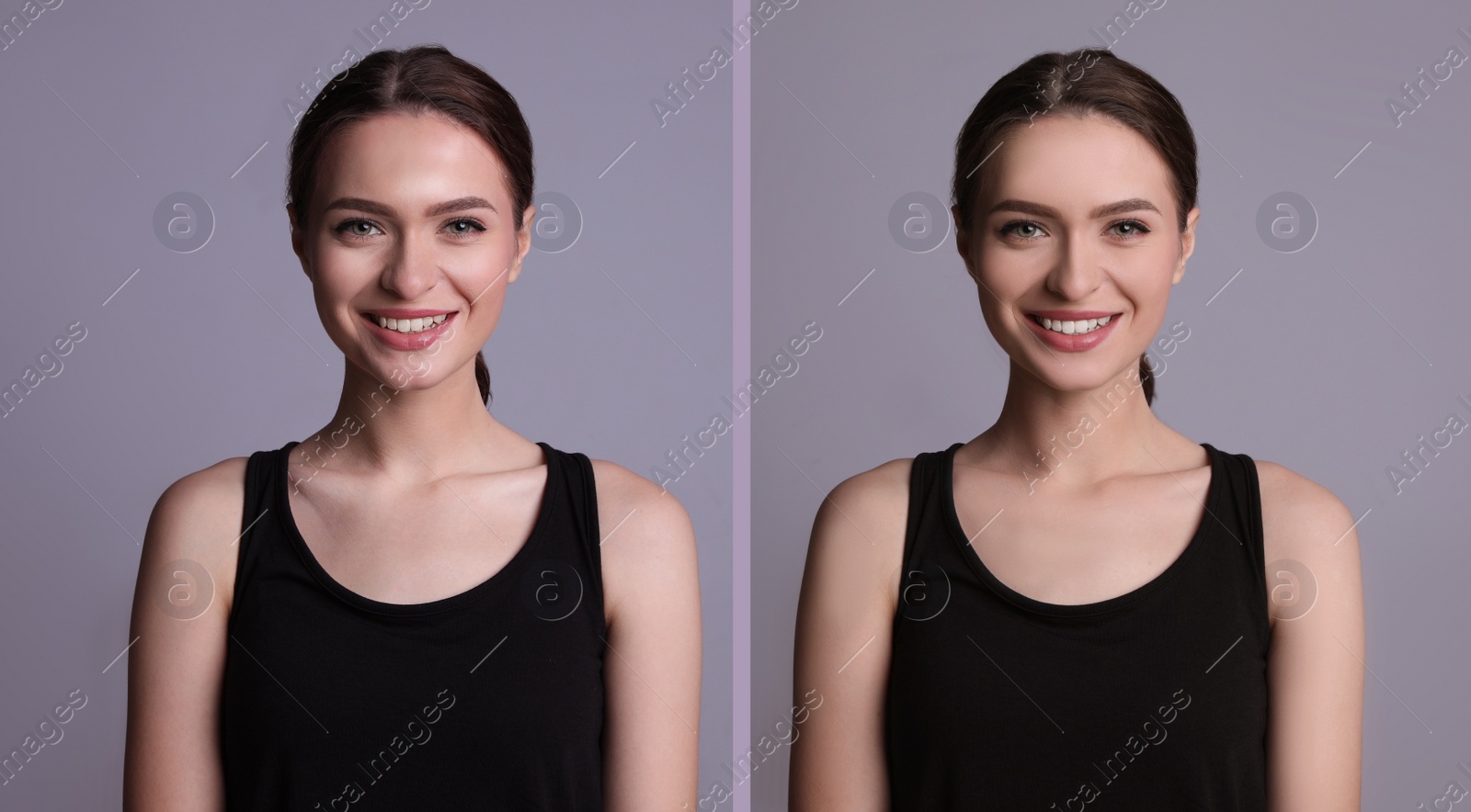 Image of Collage with photos of beautiful young woman before and after using mattifying wipes on grey background