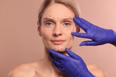 Photo of Doctor checking patient's face before cosmetic surgery operation on light brown background, closeup