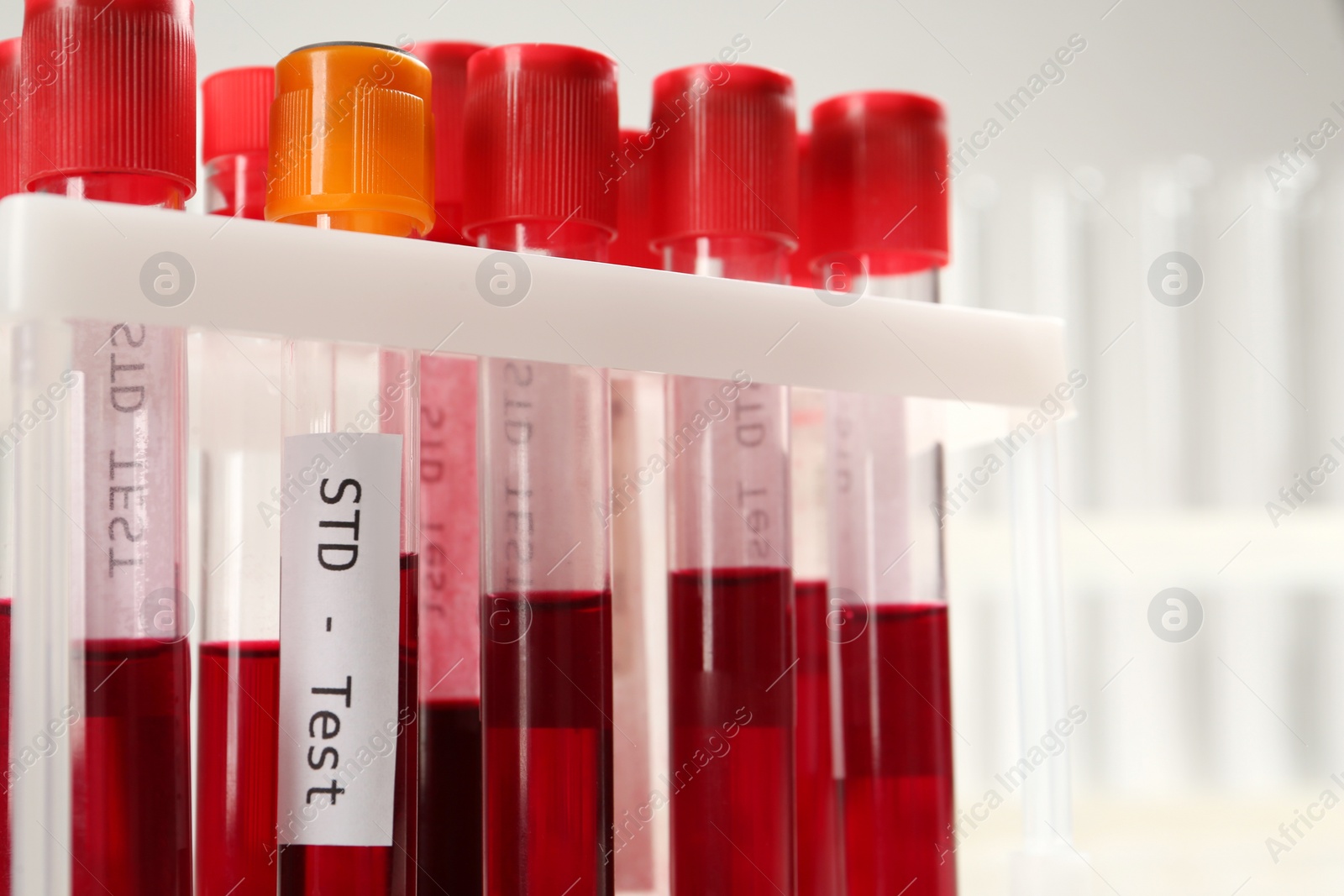 Photo of Tubes with blood samples in rack on white background, closeup. STD test