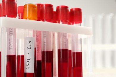 Photo of Tubes with blood samples in rack on white background, closeup. STD test