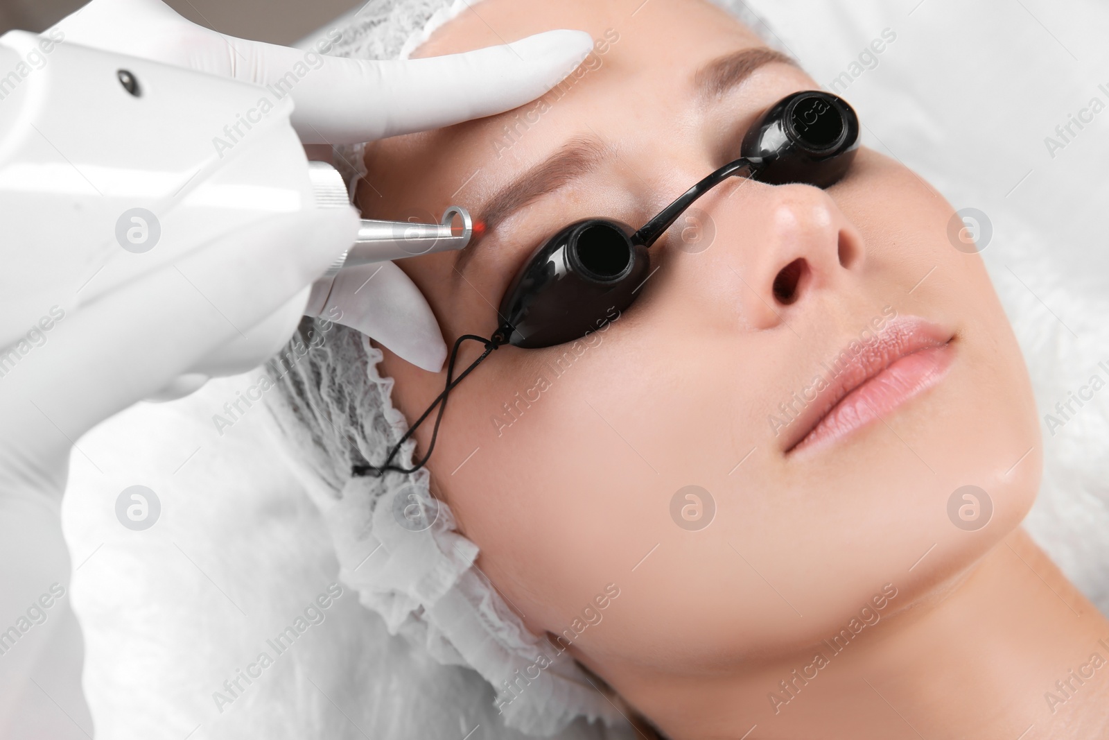 Photo of Young woman undergoing laser removal of permanent makeup in salon. Eyebrow correction