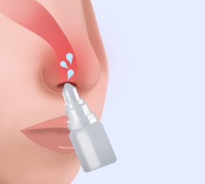 Illustration of Nasal spray advertisement poster.  person, focus on nose 