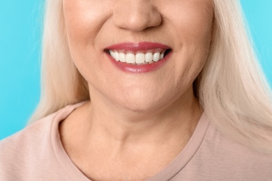 Smiling woman with perfect teeth on color background, closeup