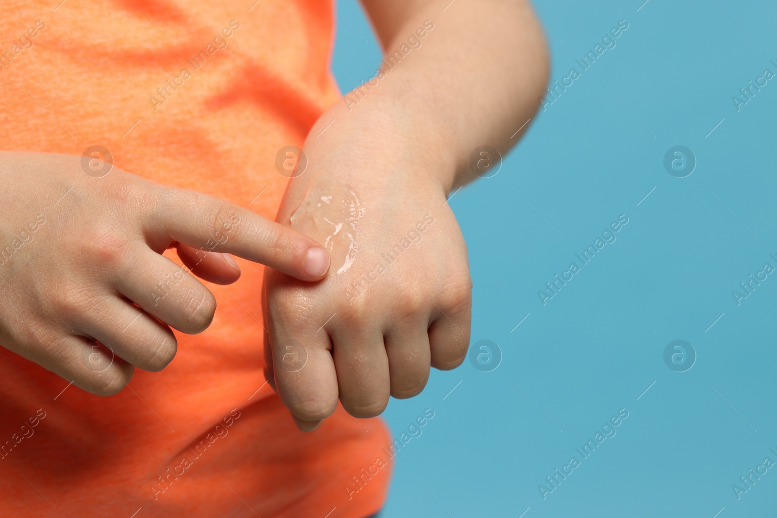 Photo of Child applying ointment onto hand against light blue background, closeup. Space for text