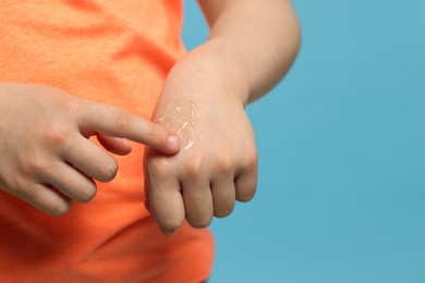 Child applying ointment onto hand against light blue background, closeup. Space for text