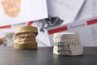 Photo of Dental models with gums on grey wooden table. Cast of teeth