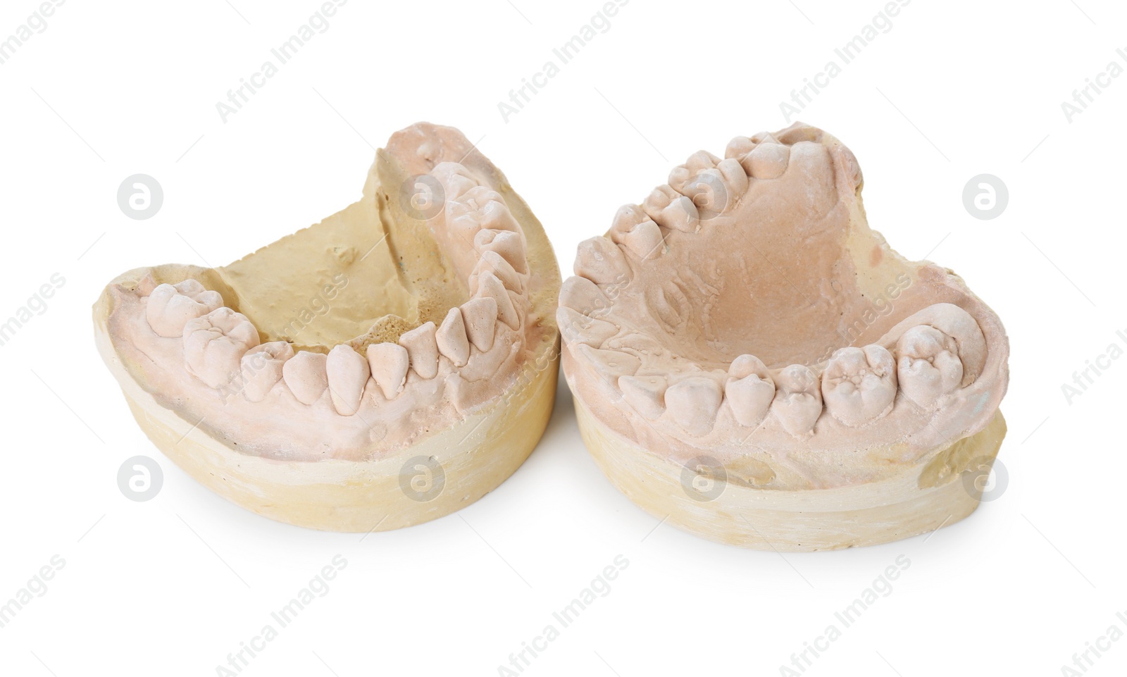 Photo of Dental model with jaws isolated on white. Cast of teeth