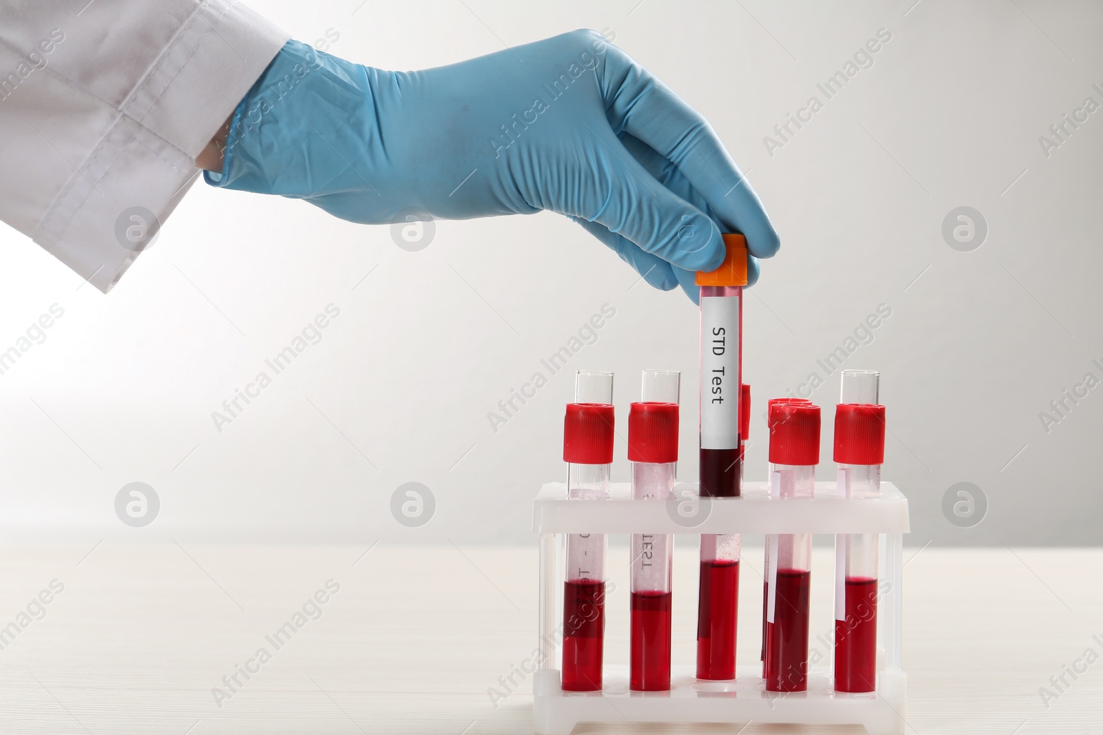 Photo of Scientist taking tube with blood sample and label STD Test from rack at white table, closeup