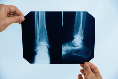 Photo of Orthopedist examining X-ray picture on viewing screen, closeup