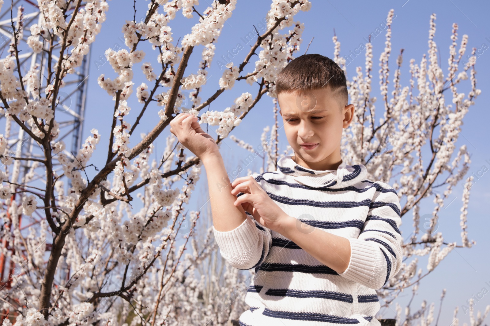 Photo of Little boy suffering from seasonal allergy outdoors on sunny day